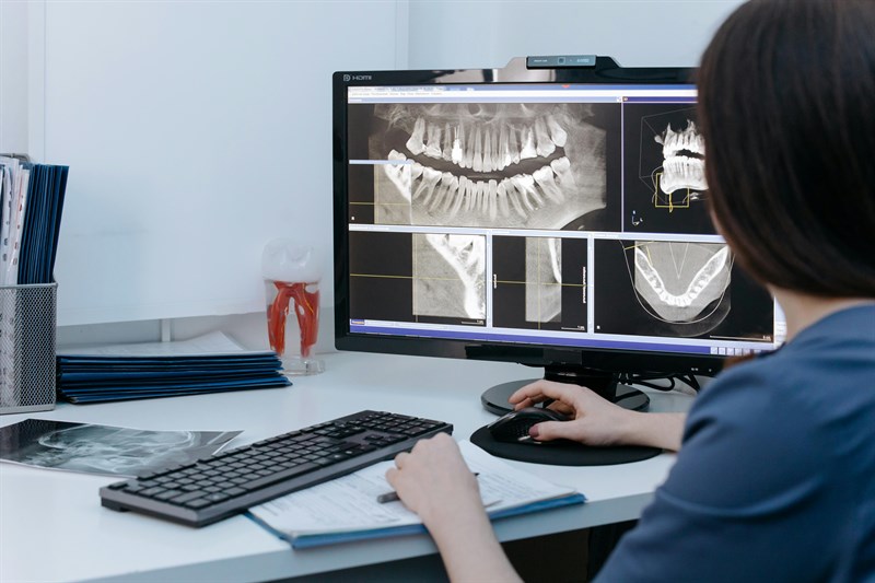 Come la tecnologia sta trasformando le cure dentistiche oggi